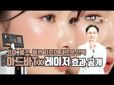 기미·홍조·혈관 치료의 새로운 선택 - 최신 ADVA 혈관레이저