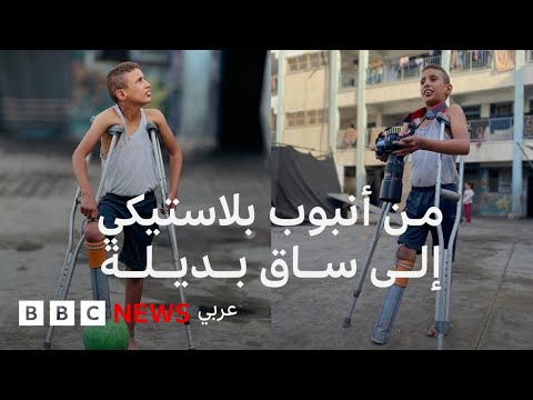 فيديو | قصة طفل غزي فقد ساقه في غارة إسرائيلية