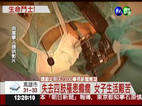 因病截肢不氣餒 女子舞動人生