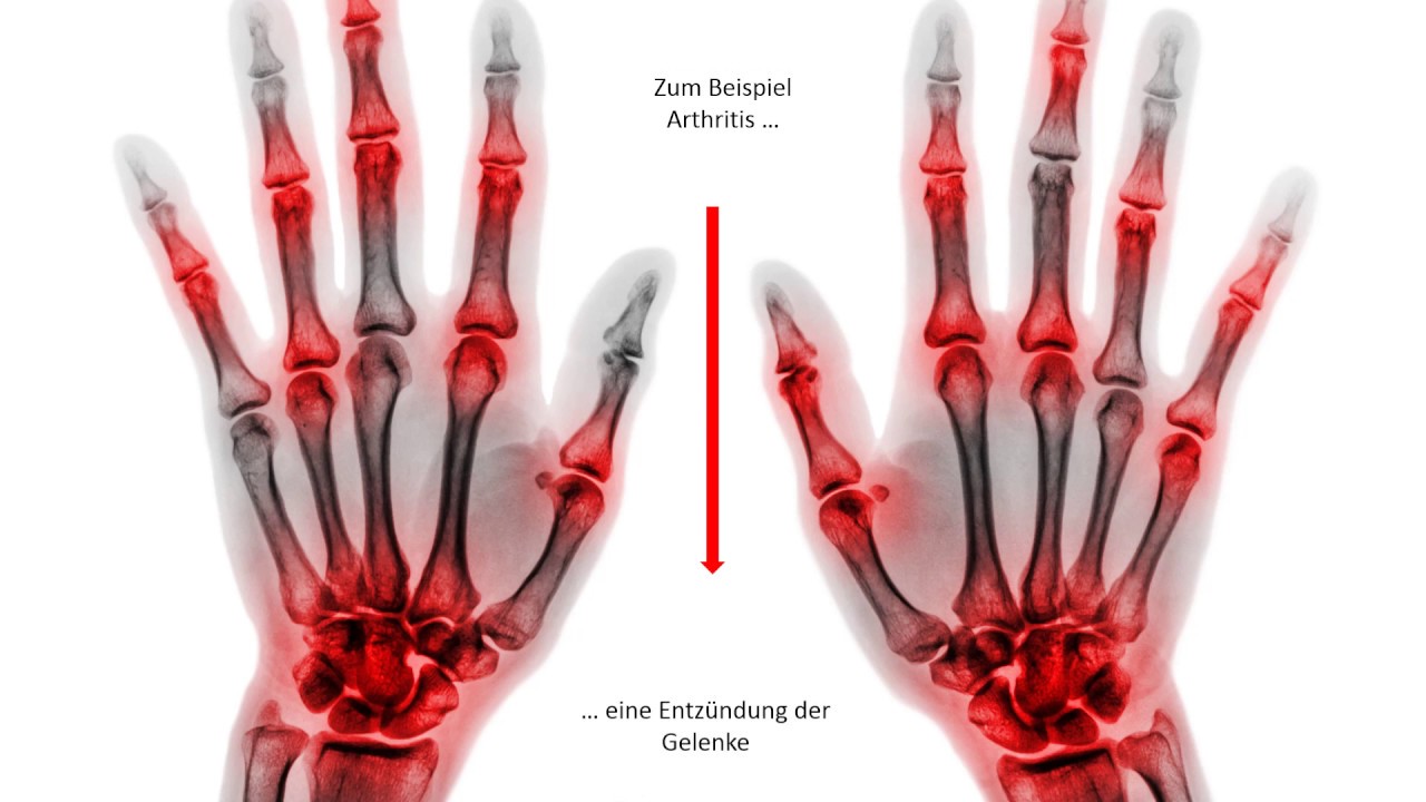 Vidéo d'entreprise PROF. DR. MED. HAIKO SPROTT