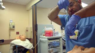 Bougie Assisted Digital Intubation
