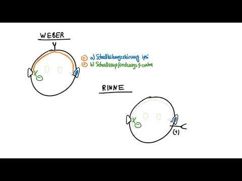 Weber und Rinne   Schallleitungsstörung vs  Schallempfindungsstörung 720p 30fps H264 192kbit AAC