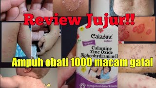 Download lagu Honest review only with Caladine lotion. Effective in treating various types of itching. mp3