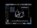 Venue Family R3 Tutorial Auto VTI