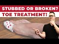 Stubbed Toe Or Broken Toe Symptoms Pain Relief Treatment