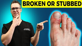Stubbed Toe or Broken Toe?  [Symptoms, Pain Relief &amp; Treatment!]