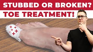 Stubbed Toe or Broken Toe?  [Symptoms, Pain Relief &amp; Treatment!]