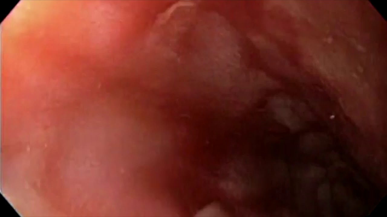 Adriana Fabiola Romano Munive-19