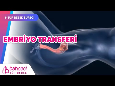 Embriyo Transferi