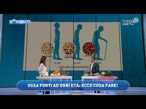 Il mio medico - L’alimentazione per rafforzare le ossa