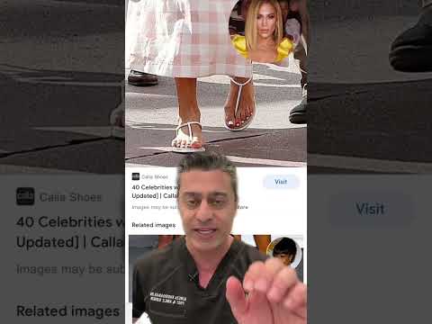Expert advice on Jennifer Lopez's foot problems #jlo