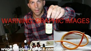 How To Kill Parasites Naturally (Rectal Suppositories)