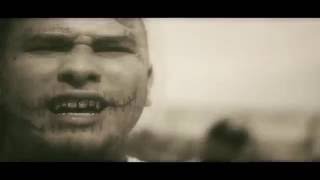 Game Over "STITCHES" Music Video