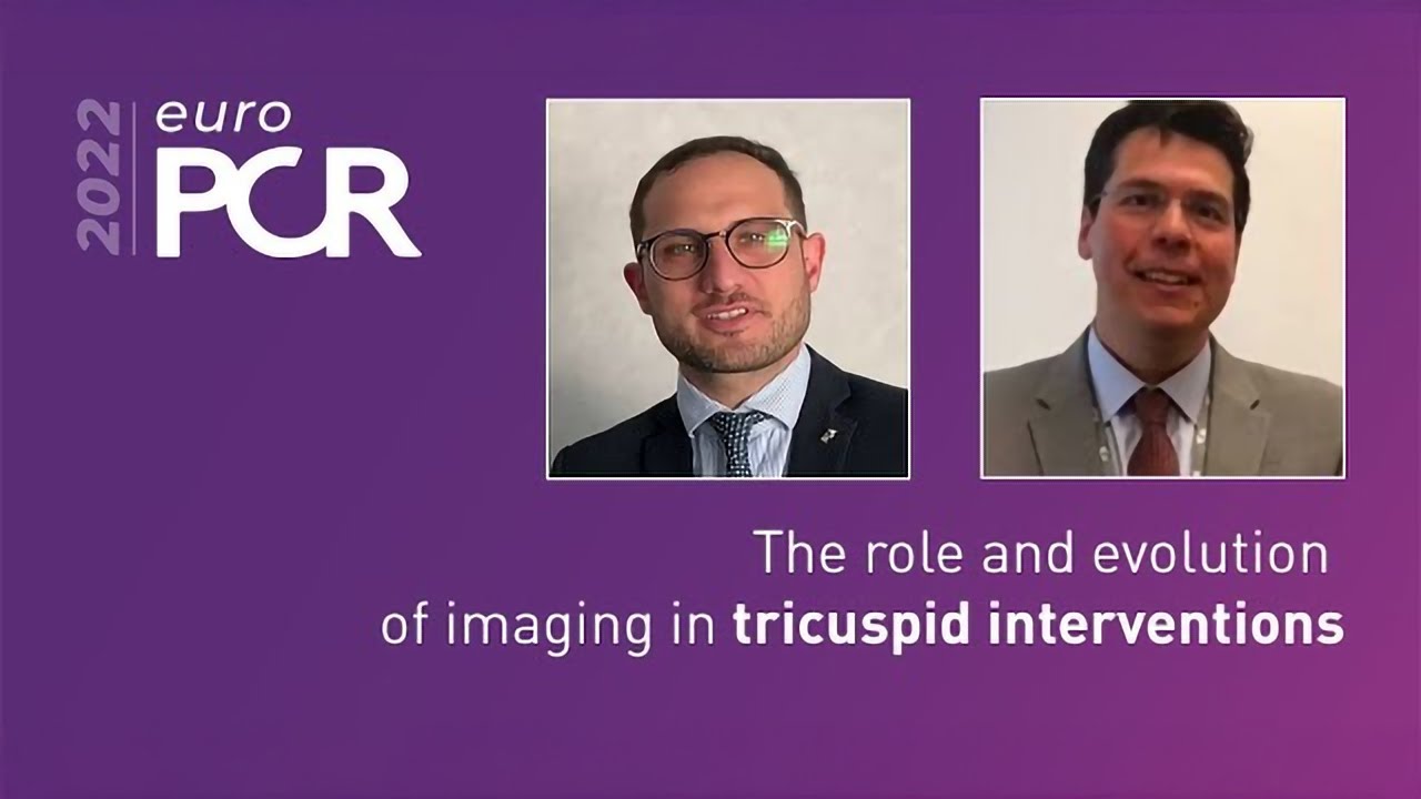 Alessandro Sticchi-38