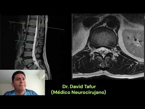 David Tafur Muñoz-3532