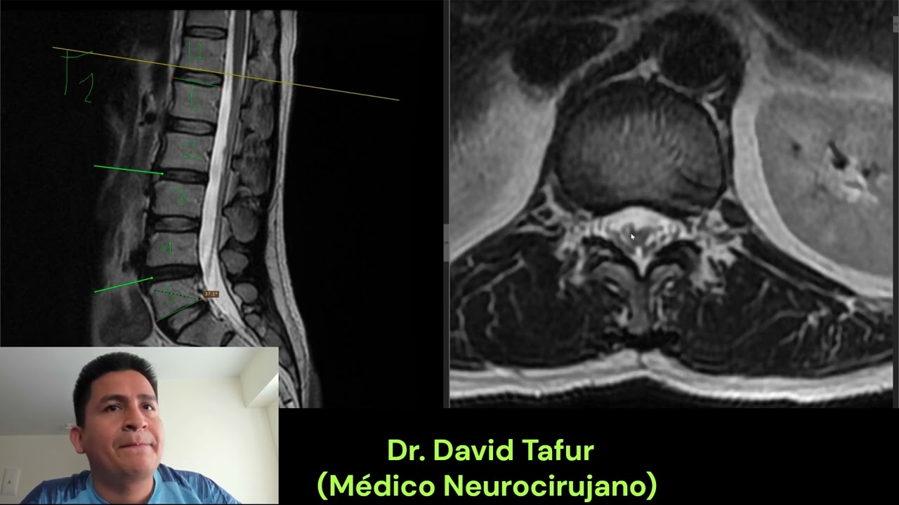 David Tafur Muñoz-2466