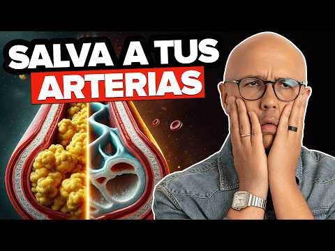 ¡BAJA el COLESTEROL NATURALMENTE ! SIN MEDICAMENTOS