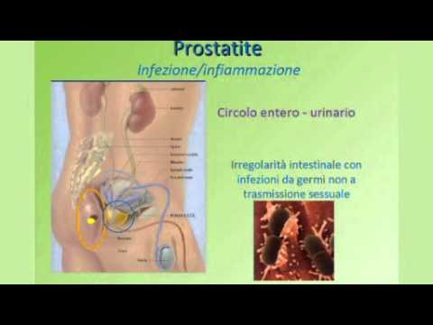 Massaggiatore della prostata in farmacia acquistare Corteccia di pioppo al trattamento della prostatite