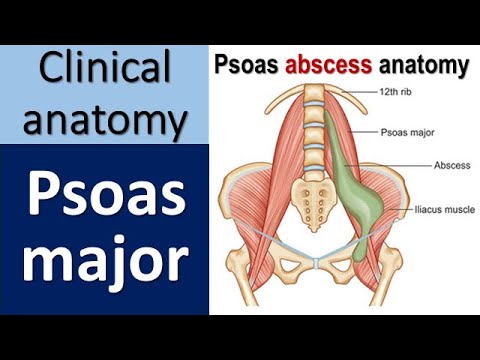 Psoas Major: Unveiling Anatomy and Clinical Insights!