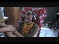 What Is Severe Autism With Self Injurious Behaviors