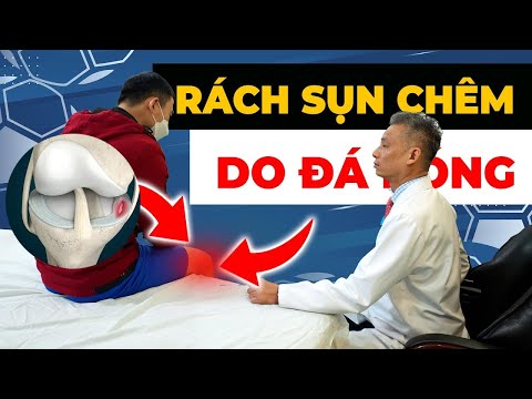 Rách Sụn Chêm Do Đá Bóng: Nỗi Đau Không Thể Chịu Nổi và Điều Trị Hiệu Quả!