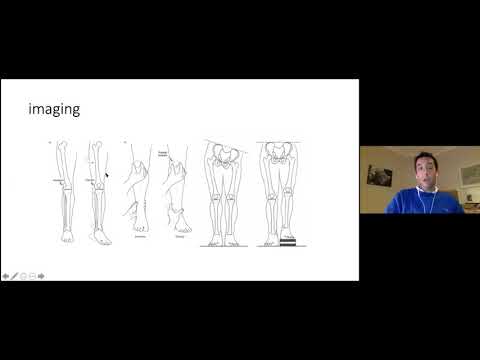 Principles of deformity correction for the FRCS