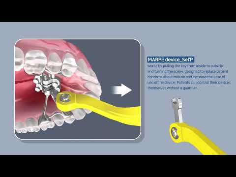 What is Sel'P? (MARPE device)