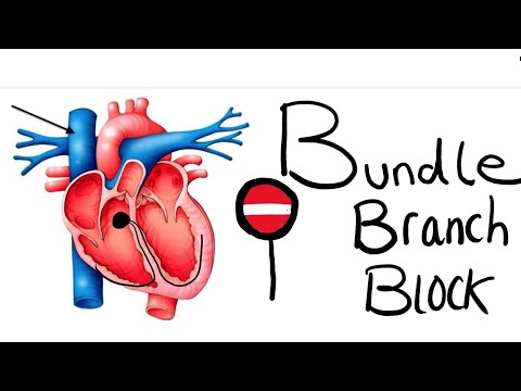 The Heart Masterclass -- Bundle Branch Blocks  (The First Episode)
