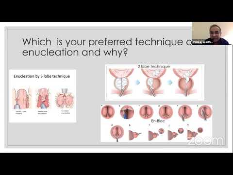 Webinar on LASER Prostatectomy || Urology ||