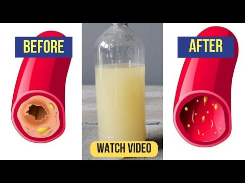 Only a Glass of This Juice will Remove Clogged Arteries And Control Blood Pressure