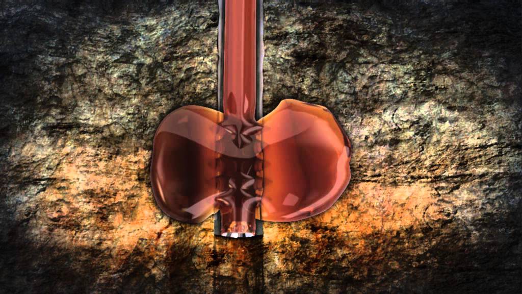 WellCem Plug & Abandon