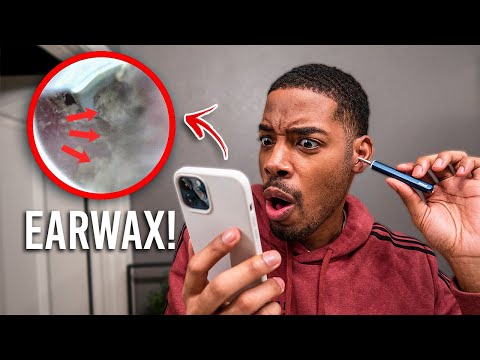 REMOVING My Own Ear Wax With A Camera! Axel Glade...