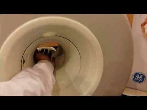 Aumento de la articulación del dedo gordo Hidropesía de las articulaciones como un regalo