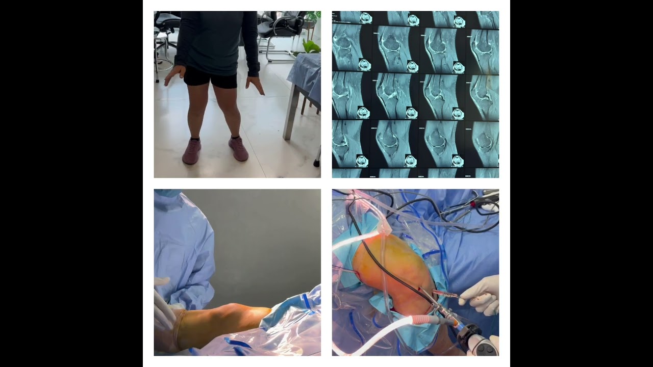 Diego Gomez Orozco-7