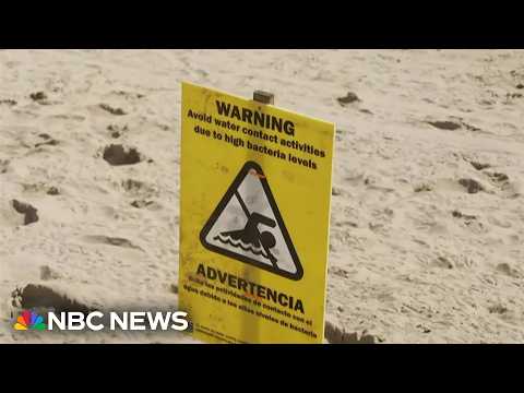 Bacteria shuts down beaches coast to coast in the U.S.