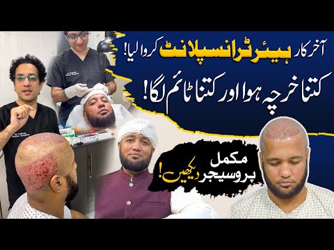 Hafiz Ahmed Hair Transplant Complete Procedure | Hafiz...