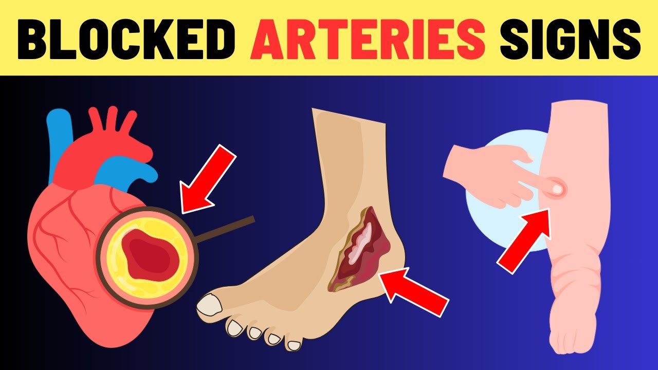 7 Warning Signs of Blocked Heart Arteries In Legs and Feet (Don't Ignore These Signals) | VisitJoy