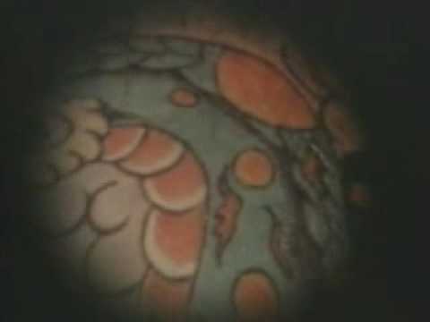 Angry Anderson - Suddenly (1987)