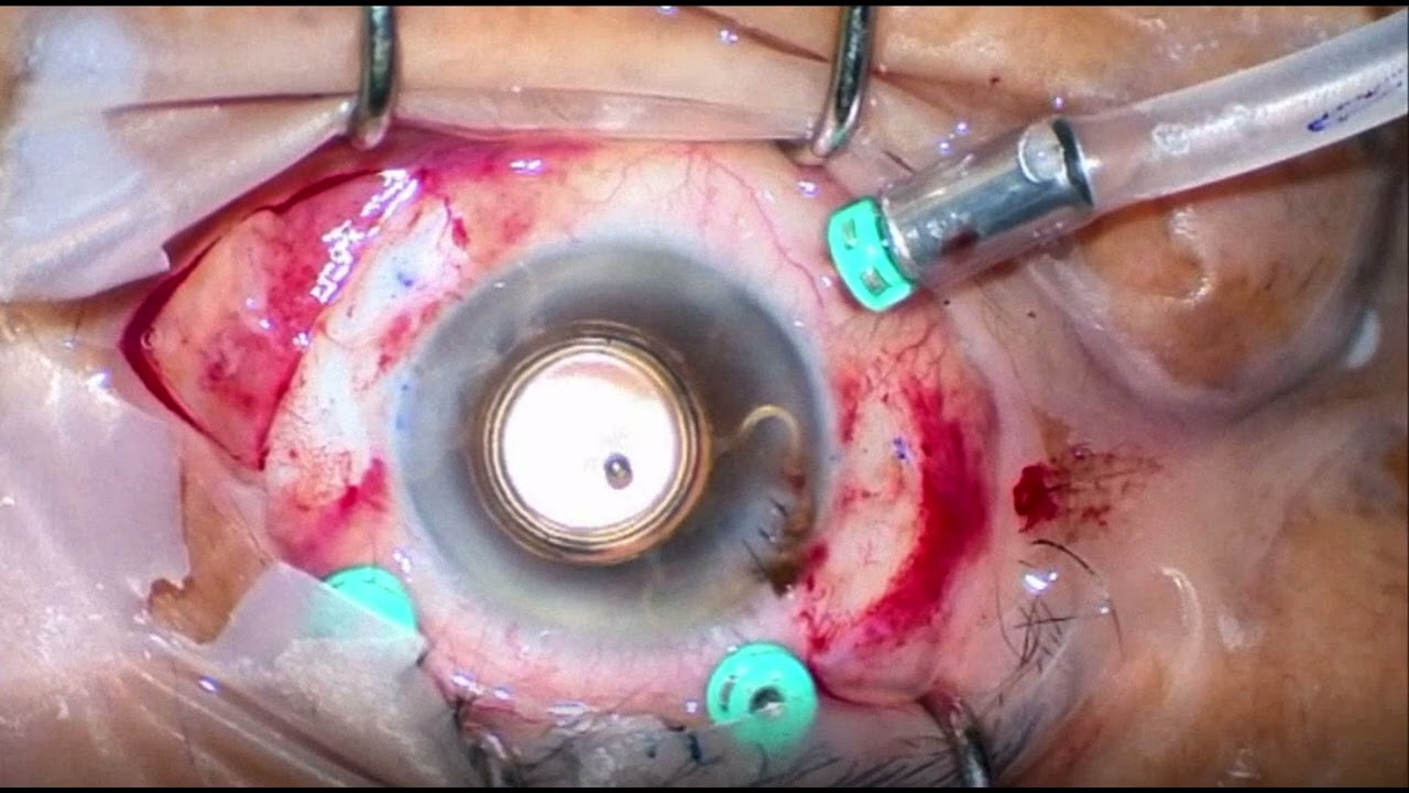 José Francisco Valdez López-15