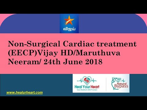 Non-Surgical Cardiac treatment (EECP)Vijay HD/Maruthuva Neeram/ 24th June 2018