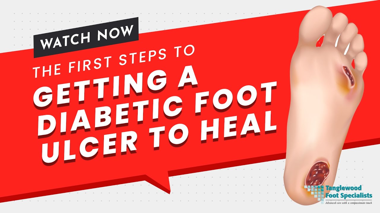 The First Steps to Getting a Diabetic Foot Ulcer to Heal