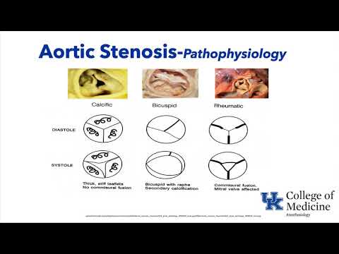 Valvular Heart Disease - Dr. Schell