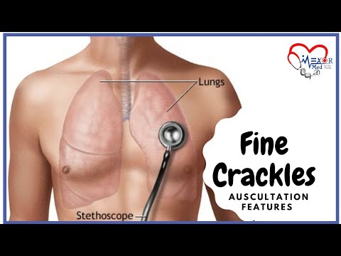 Fine Crackles - Lung Sounds - Auscultation Features
