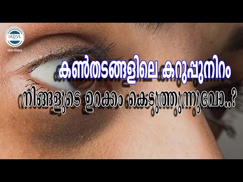 IADVL KERALA ചർമ്മാരോഗ്യ൦ -(Under Eye Darkness) കൺ