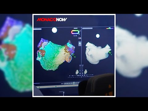 précision diagnostique avec intelligence artificielle