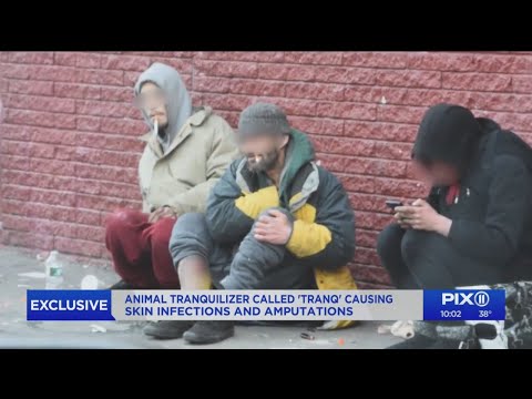 ‘Tranq’ users talk about skin-eating drug that can lead to amputation