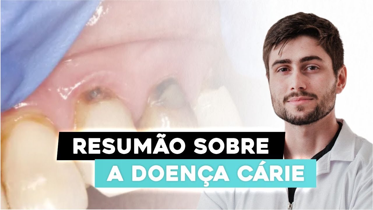 Cariologia: O que é, tratamentos e prevenção | Guia Completo