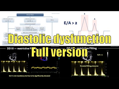 〖Echocardiography〗 Diastolic dysfunction (full version) 💘