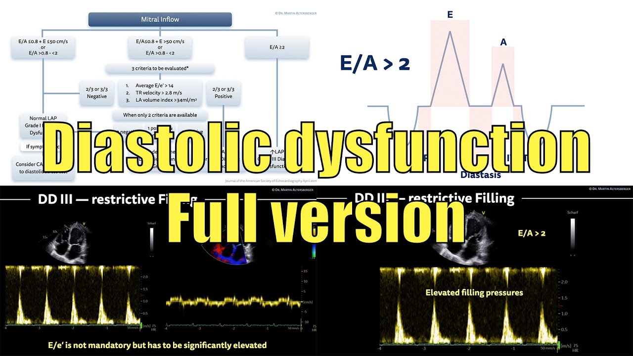 〖Echocardiography〗 Diastolic dysfunction (full version) 💘