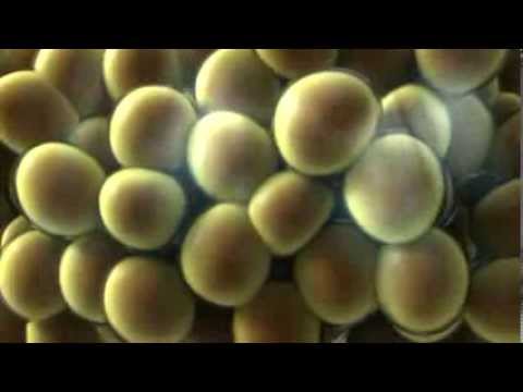 Explaining CoolSculpting - Dr. Danielpour